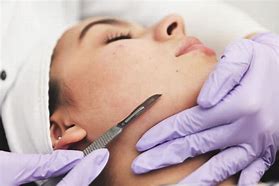 The Benefits of Dermaplaning for Radiant